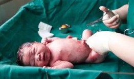 剖腹产视频,直观呈现母婴安全守护